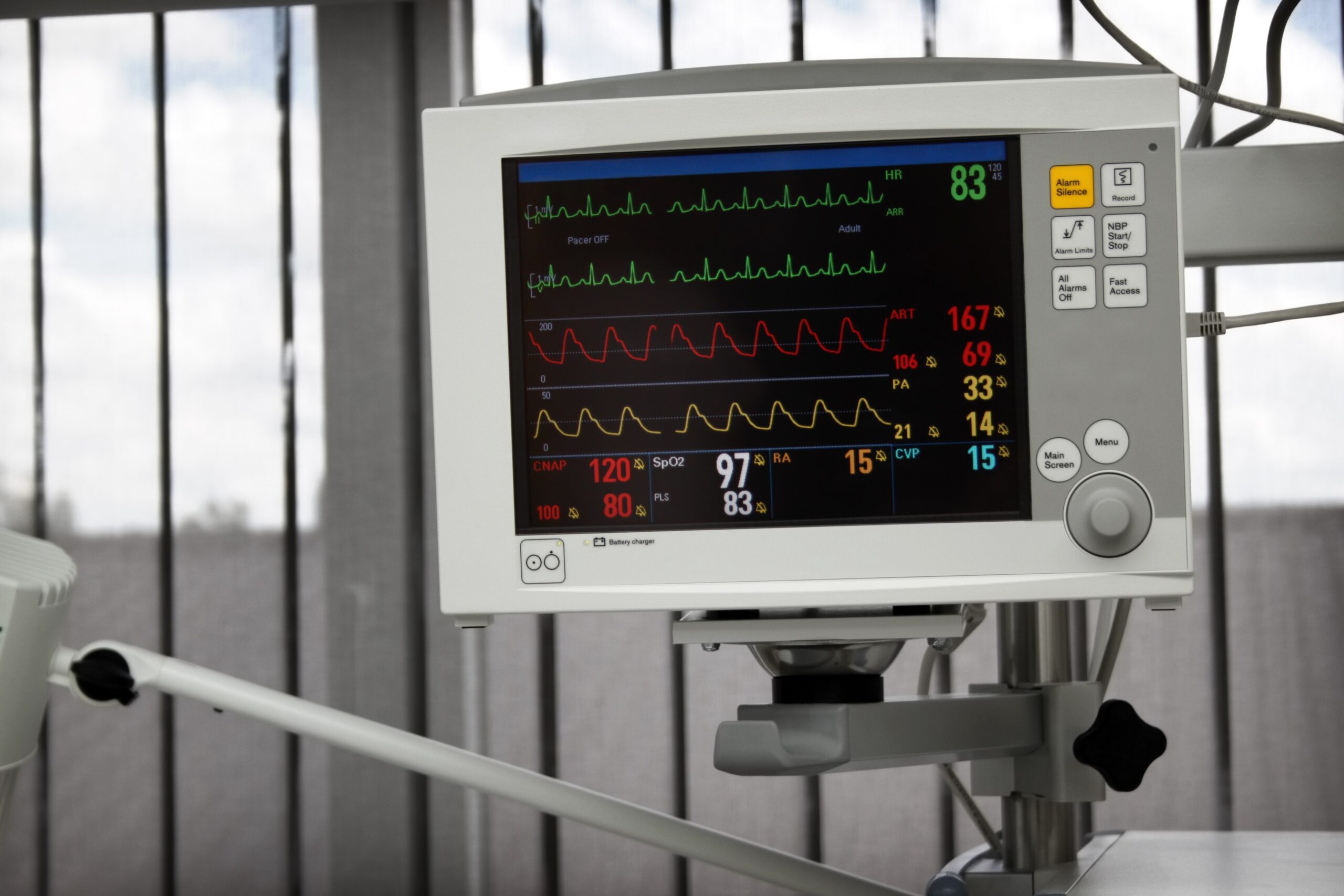 ECG machine with traces on the screen